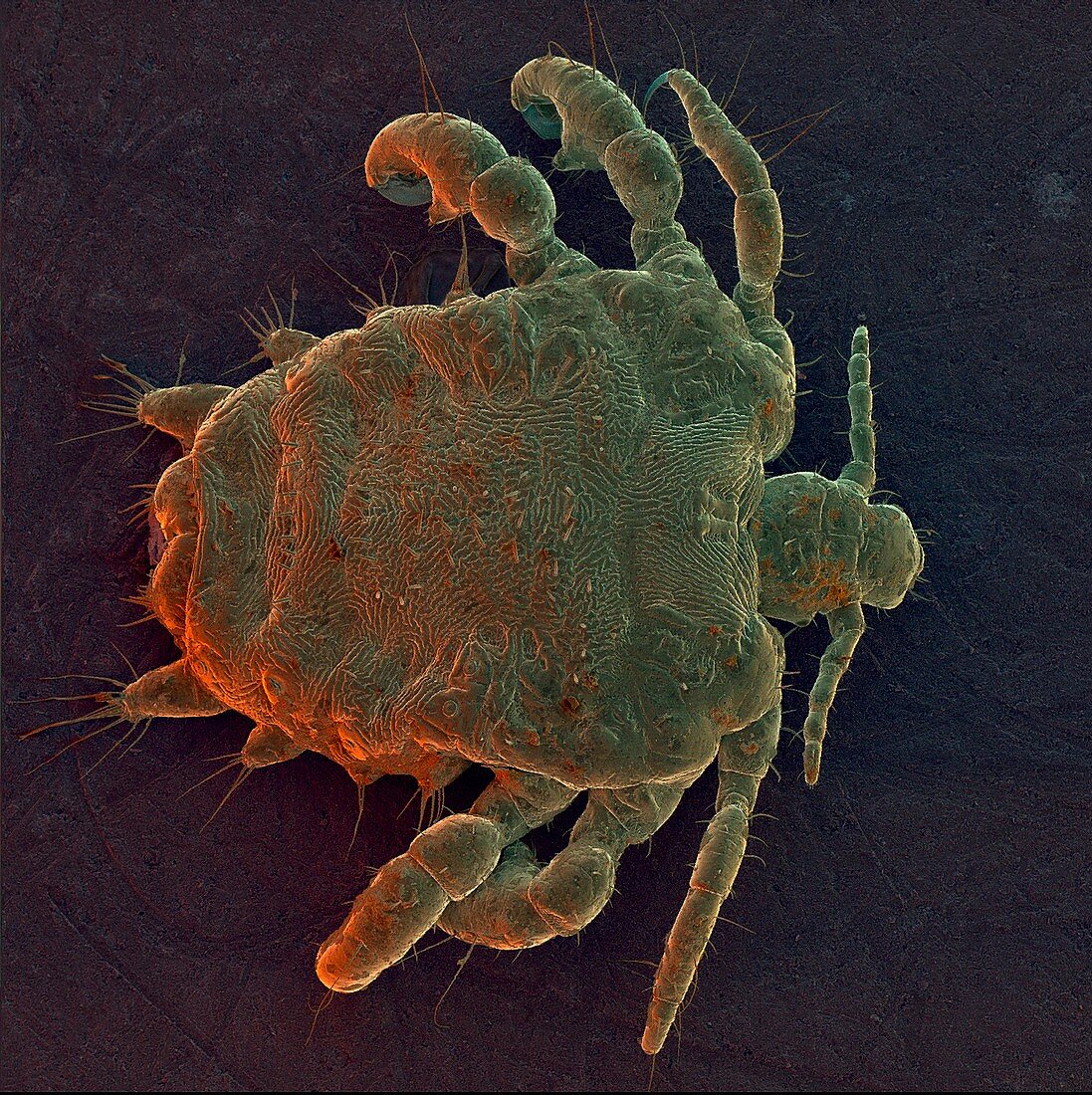 Coloured SEM of a human crab louse,Phthirus pubis