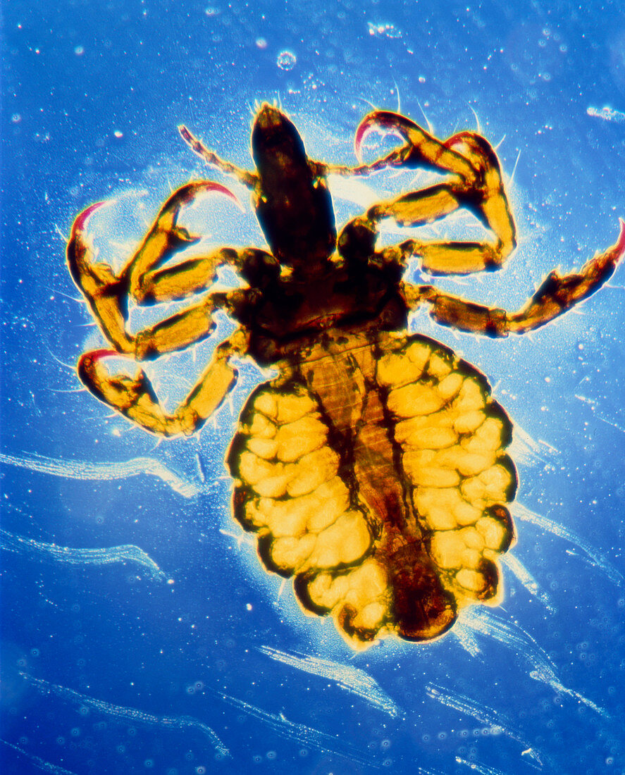 LM of human body louse,Pediculus humanus corporis