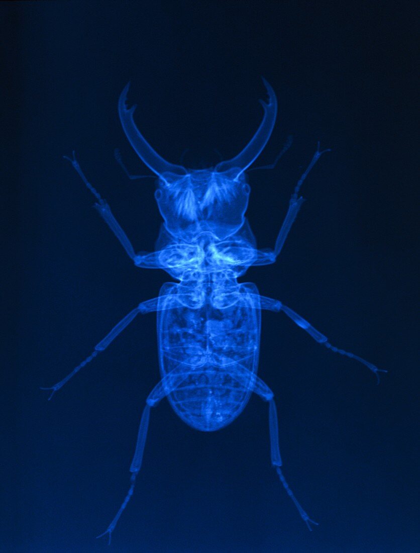 X-ray of a stag beetle,Lucanus cervus