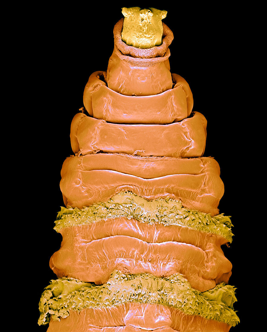 Coloured SEM of a surgical maggot (Lucilia sp.)