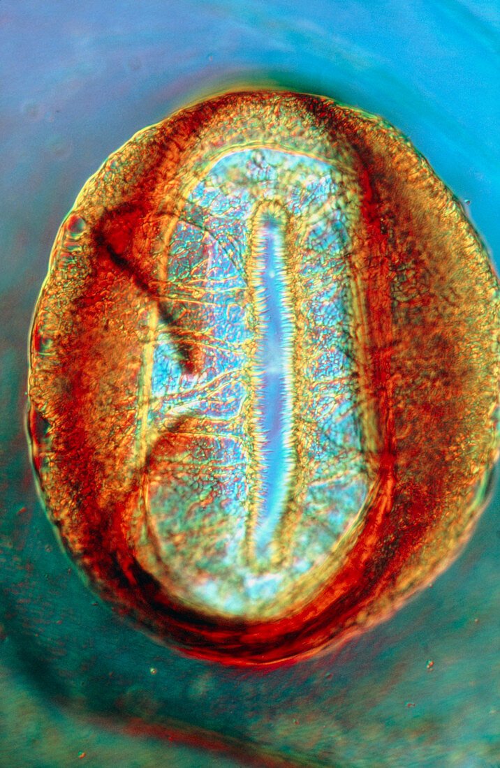 LM of a thoracic spiracle in the silkworm