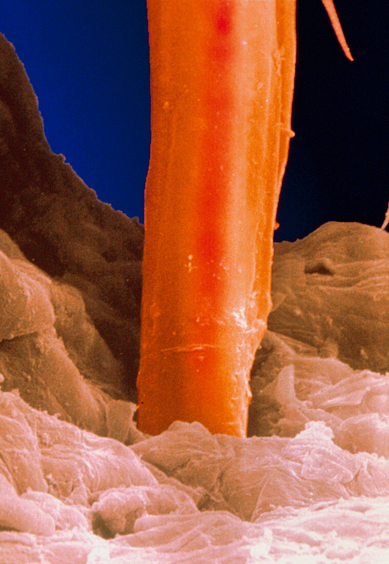 Electron micrograph of cat flea stylet in skin