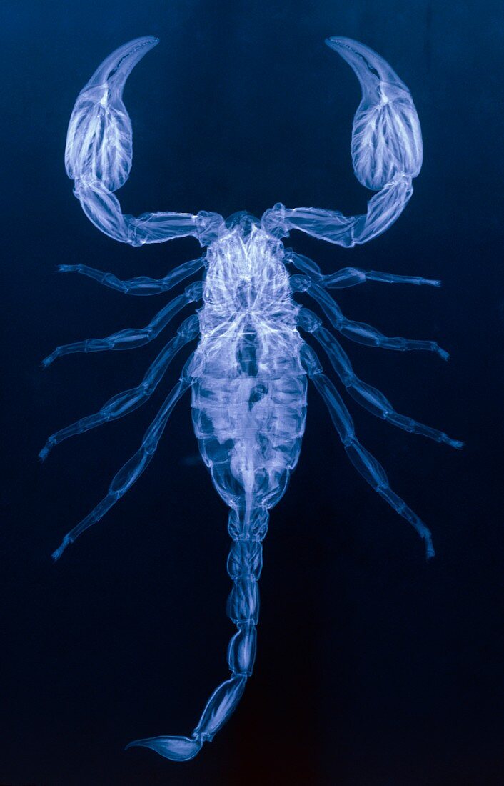 X-ray of the scorpion,Palamnaeus fulvipes