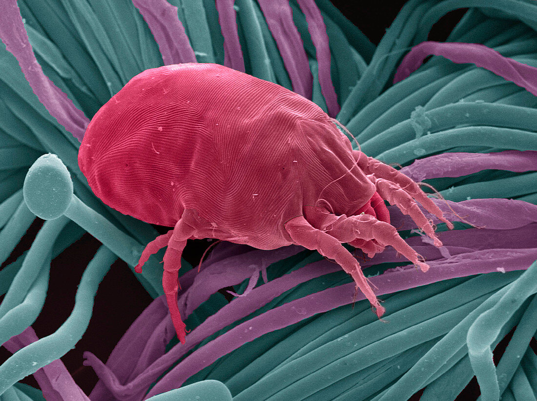 Dust mite,SEM