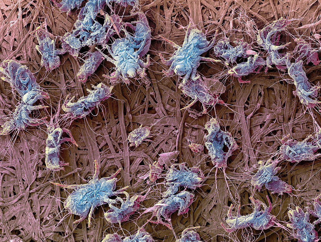 Dust mites,SEM