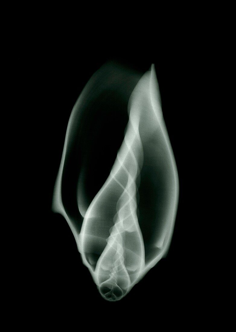 X-ray of an unidentified whelk shell