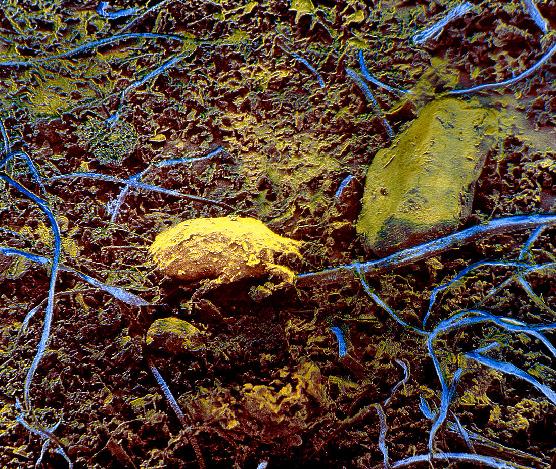 False-col SEM of a dust mite,Dermatophagoides sp