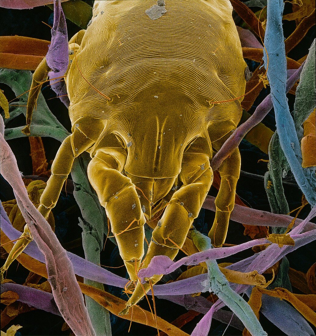 False-col SEM of dust mite,Dermatophagoides sp