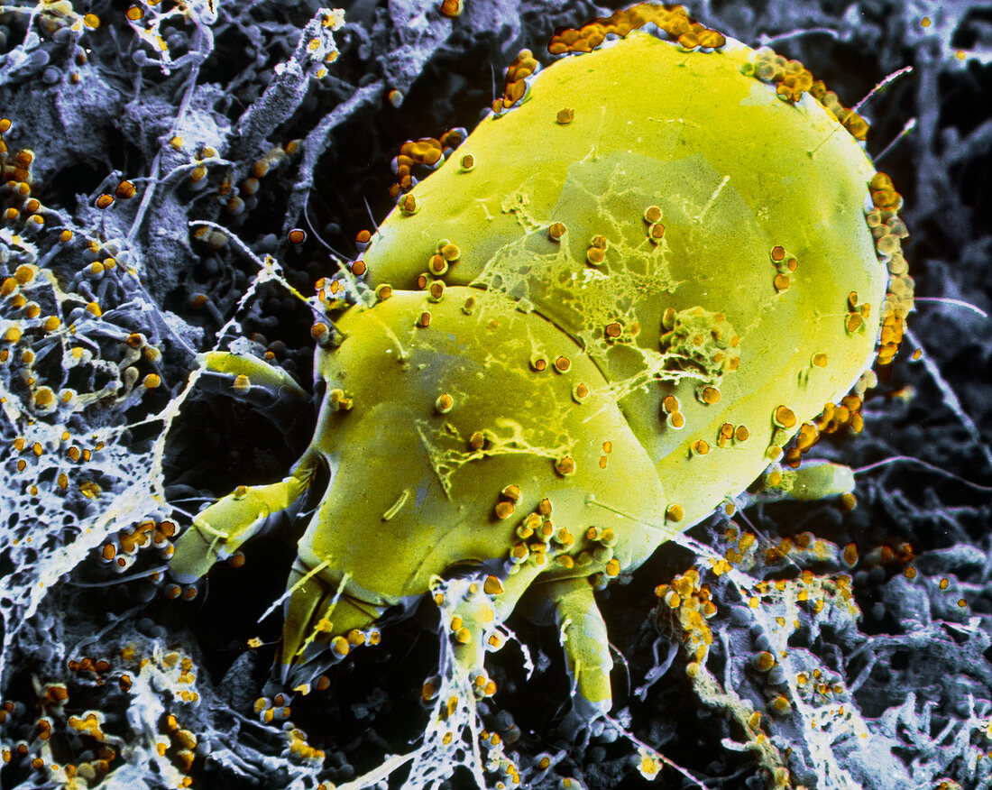 F/col SEM of dust mite