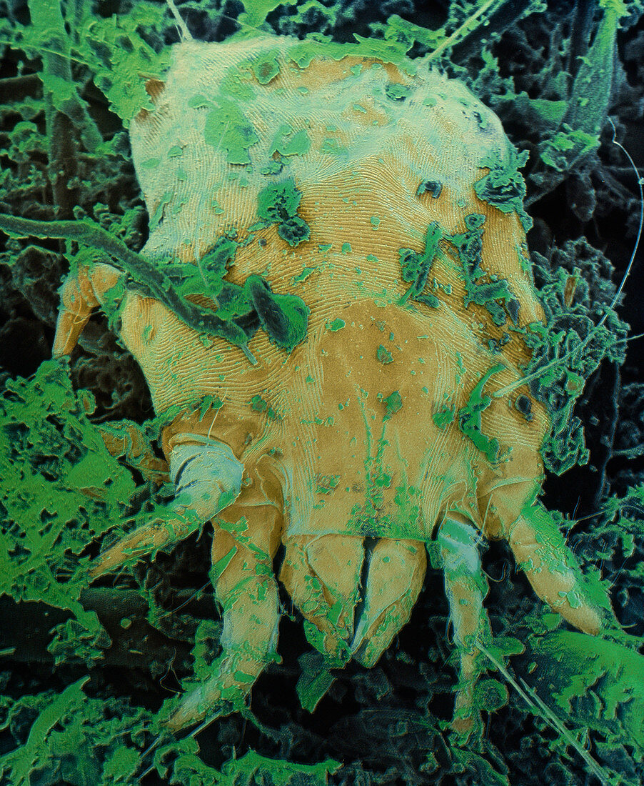 False colour SEM of Dermatophagoides,a dust mite