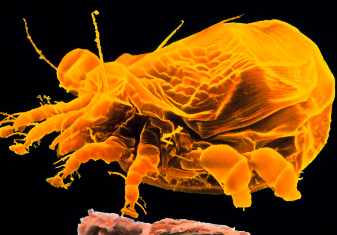 Coloured SEM of Sarcoptes sp,the itch mite