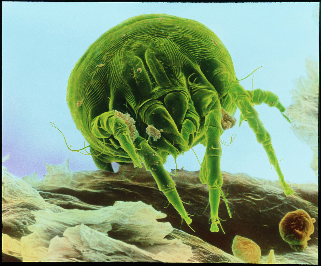 Colour scanning electron micrograph of a dust mite