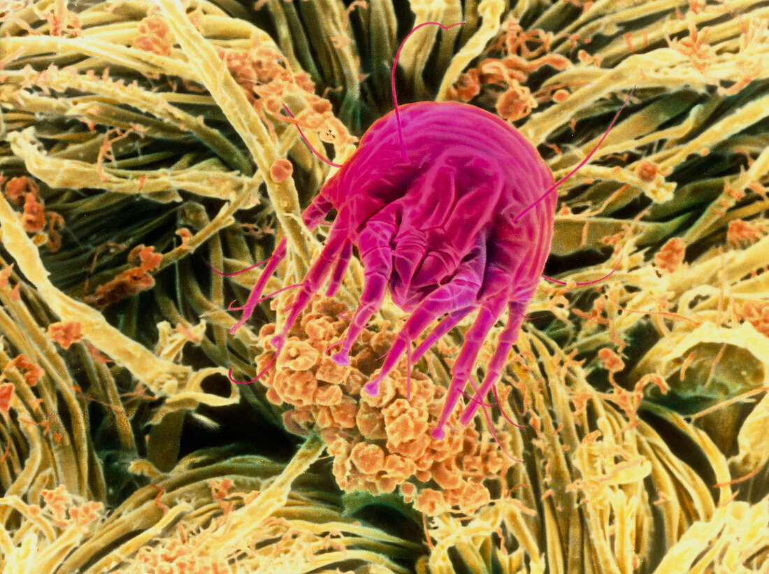 Coloured SEM of a dust mite on a bedsheet