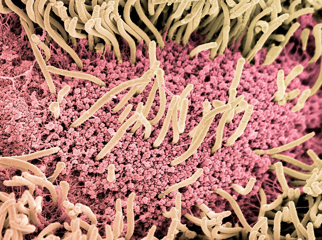 Underside of a slug,SEM