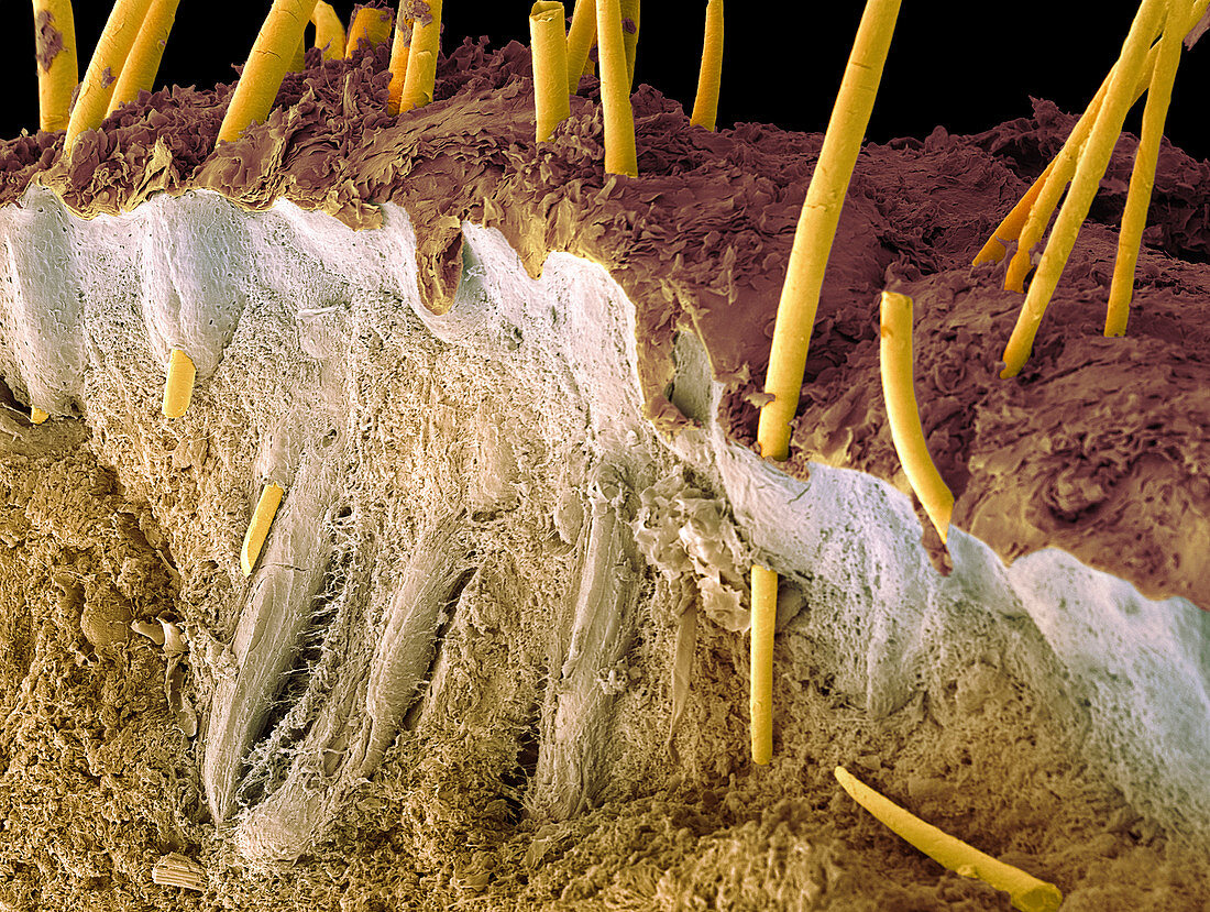 Hedgehog skin and spines,SEM