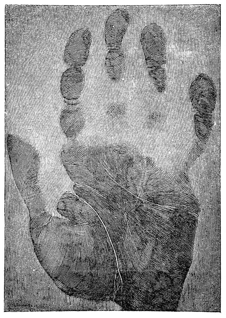 Handprint forensics,19th century