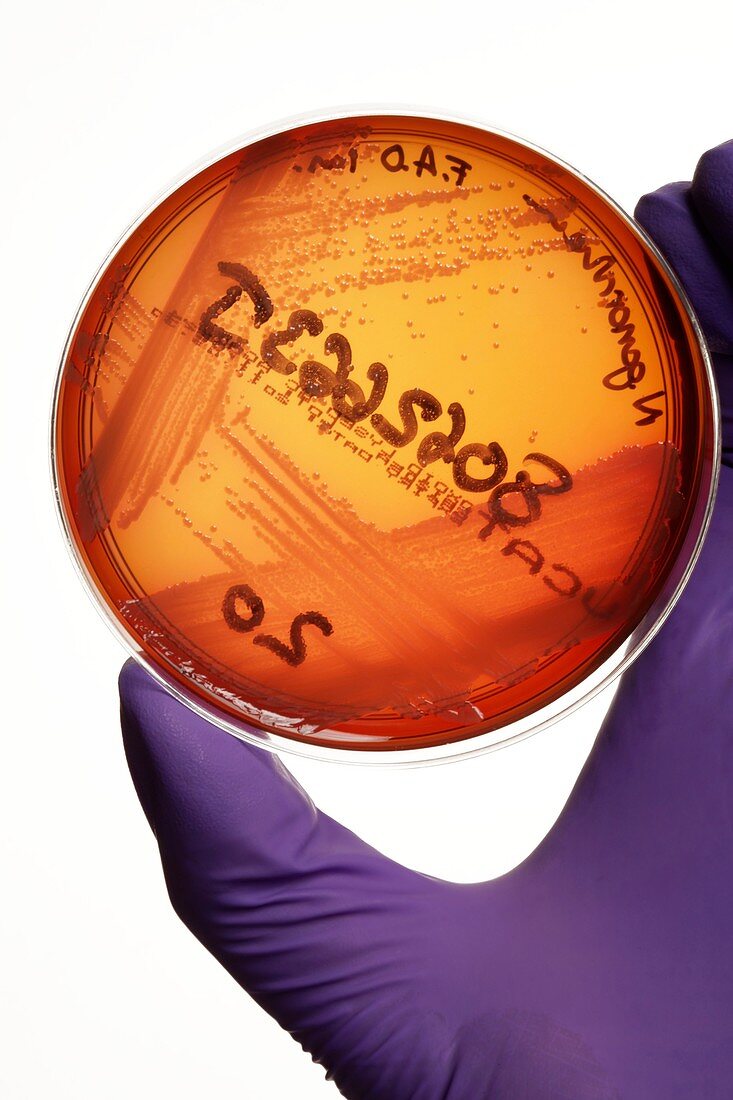 Gonorrhoeae bacteria in a petri dish