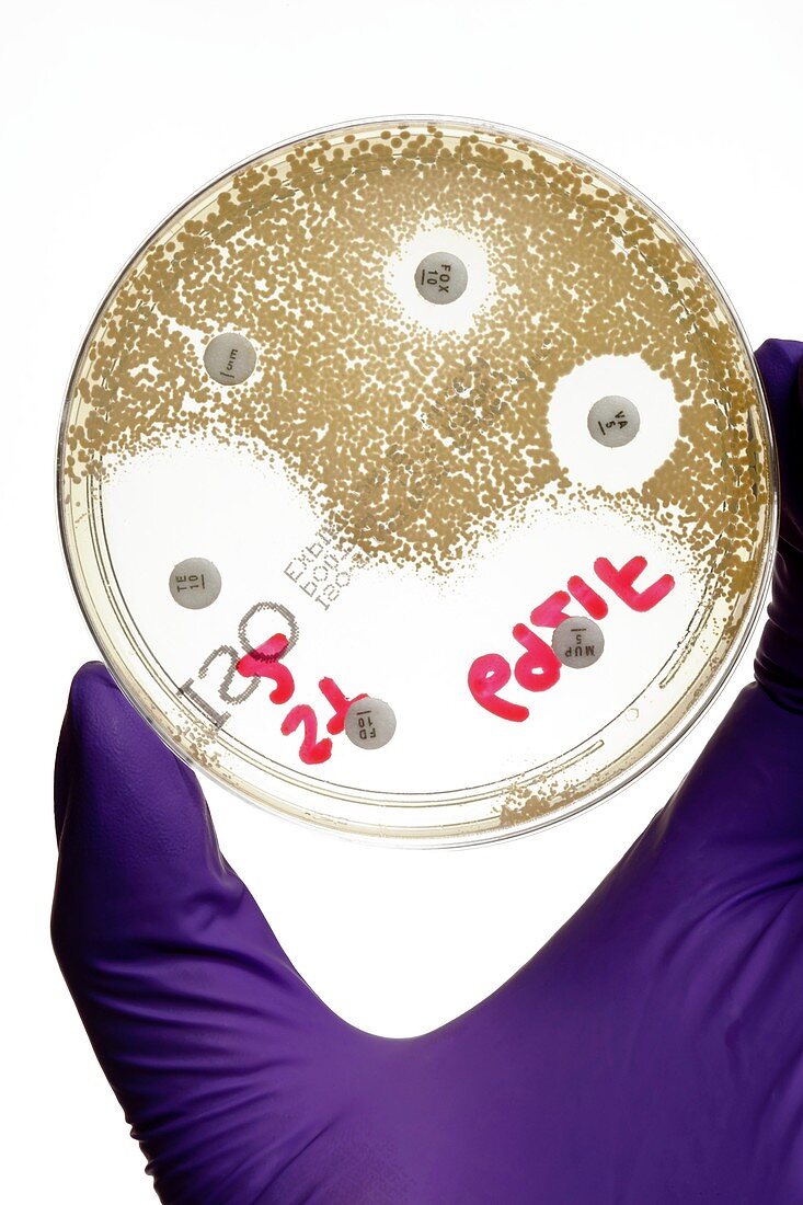 MRSA bacteria resistant to cefoxitin