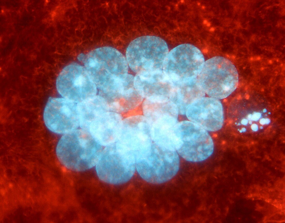 Fibroblast cells,fluorescence micrograph