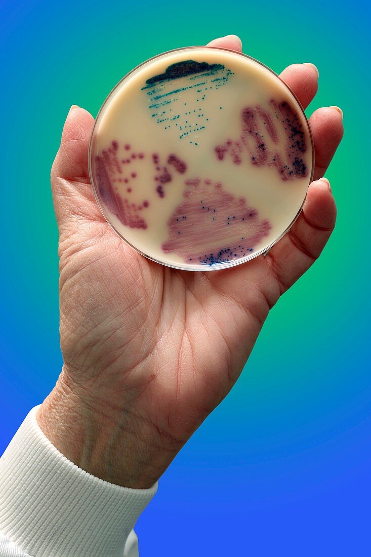 Cultured E.coli and Enterococcus bacteria