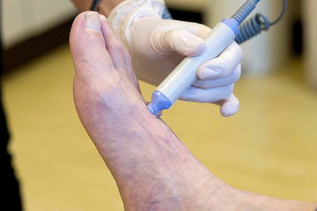 Foot pulse test for a diabetic