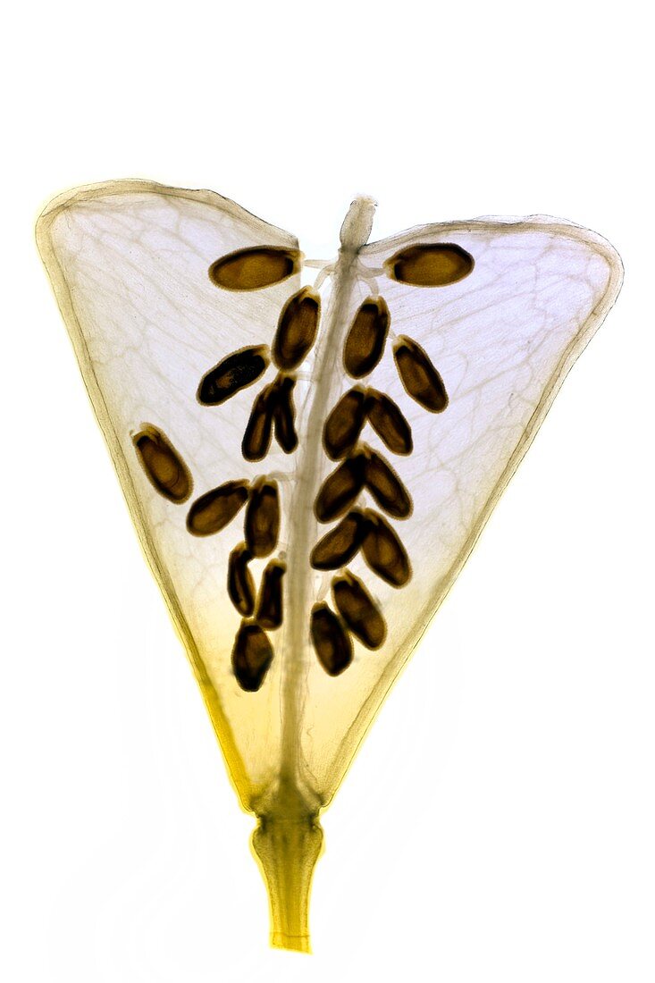 Shepherd's purse fruit,light micrograph