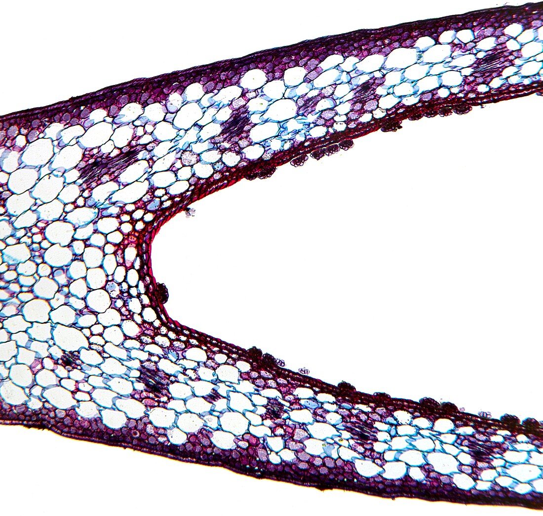 Venus flytrap leaf,light micrograph