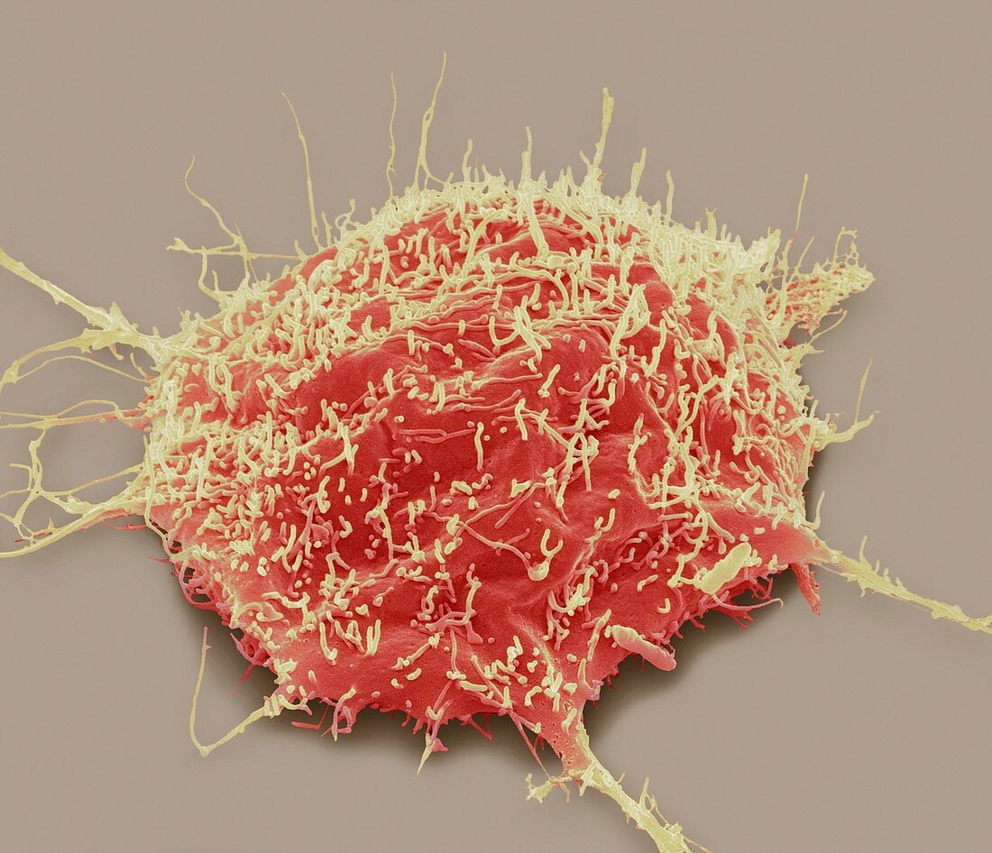 Brain cancer cell,SEM