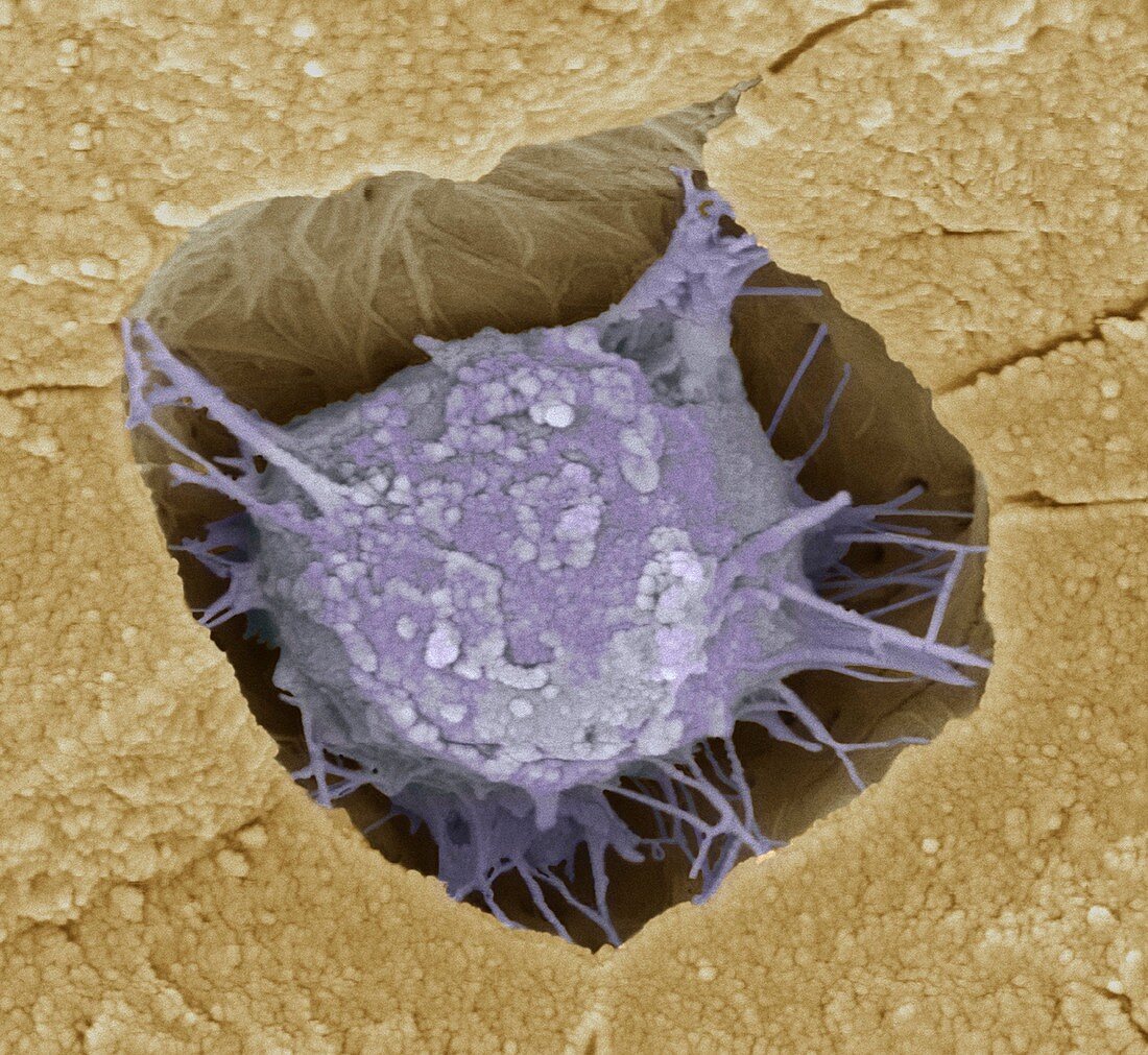 Osteoblast bone cell,SEM