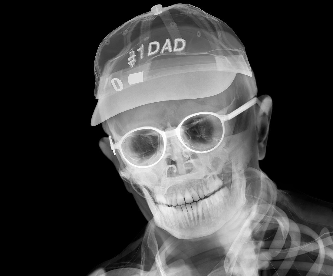 Father wearing a baseball cap,X-ray