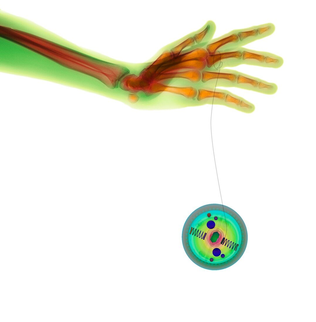 Hand and yo-yo,X-ray