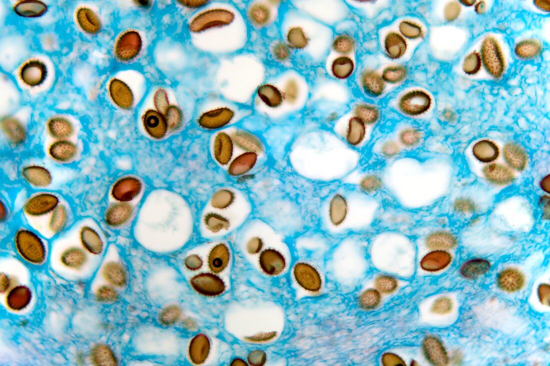 Truffle fungus,light micrograph