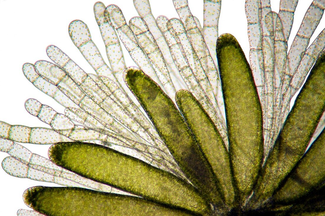 Mnium moss,light micrograph
