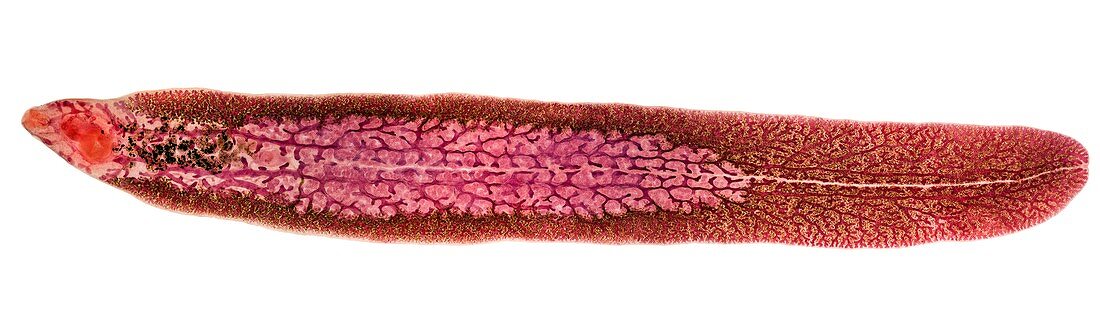 Beef liver fluke,light micrograph