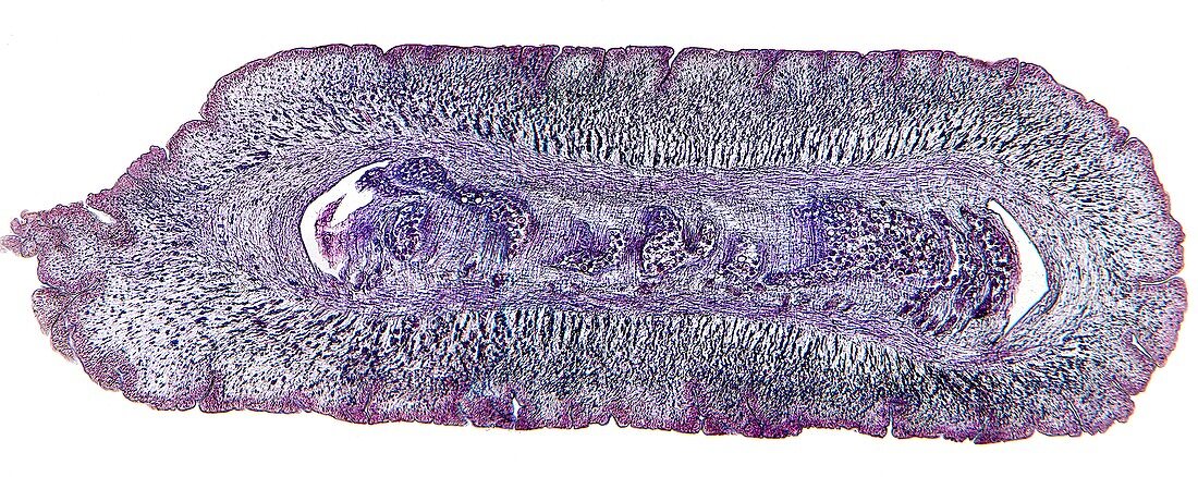 Tapeworm proglottid,light micrograph
