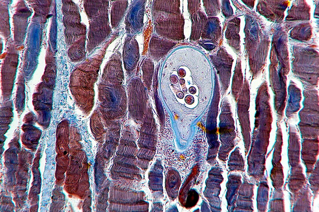 Nematode larval cyst,light micrograph