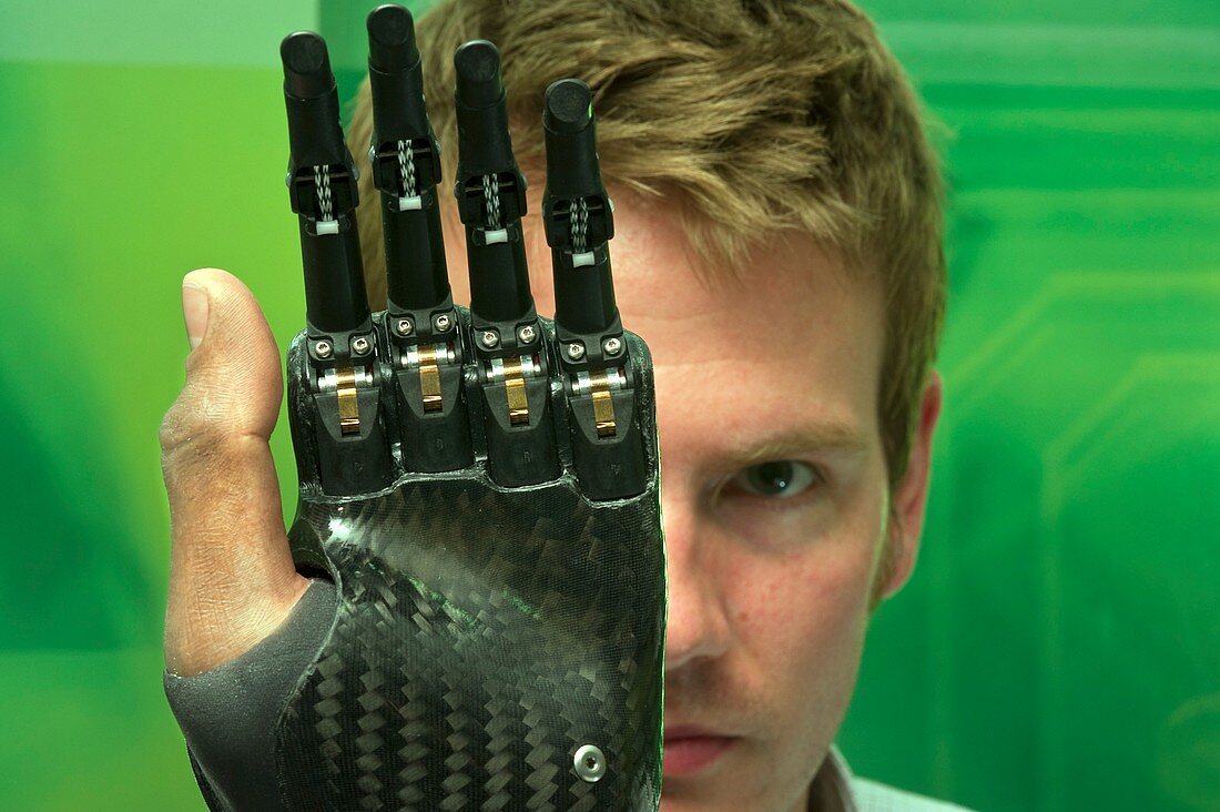 i-LIMB digits prosthetic fingers