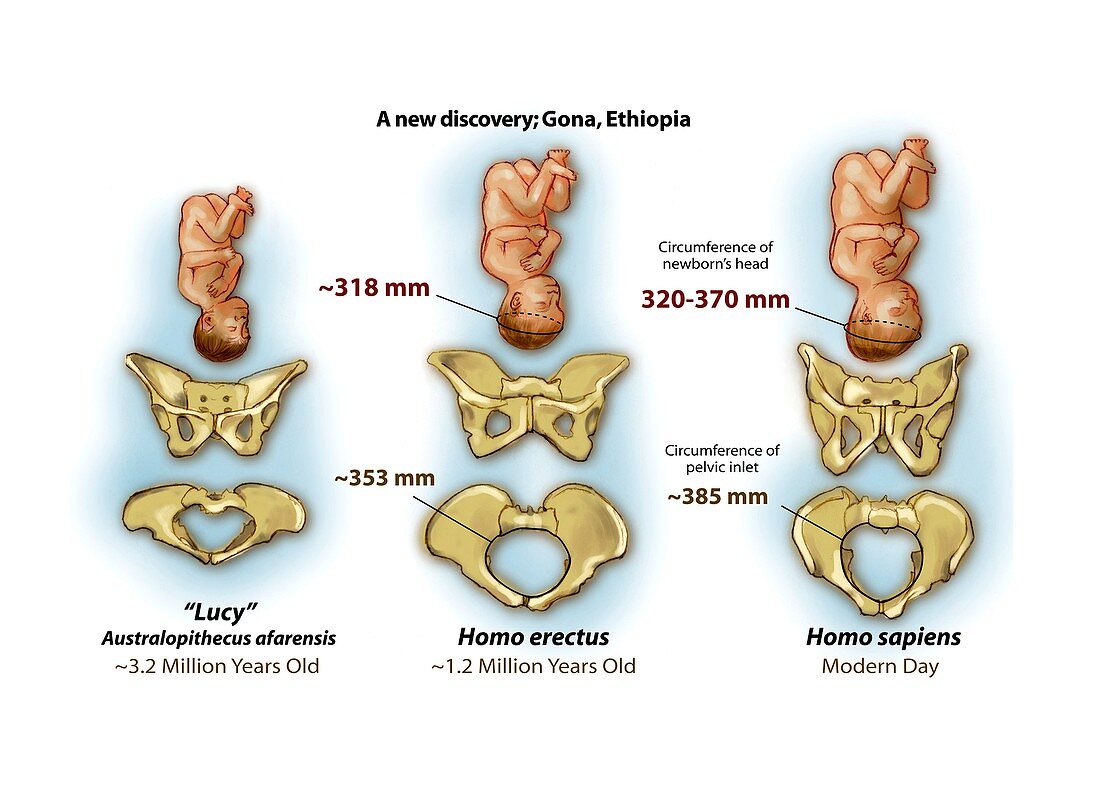 Comparison of hominin pelvic bones