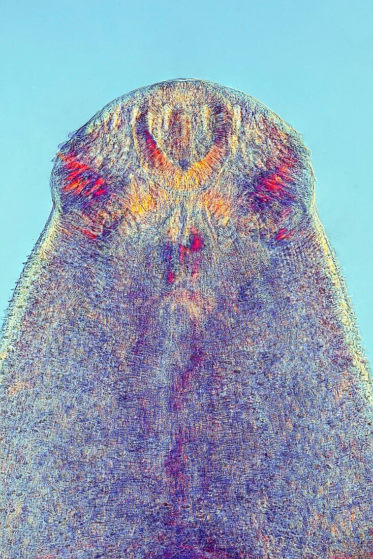 Fluke worm,light micrograph
