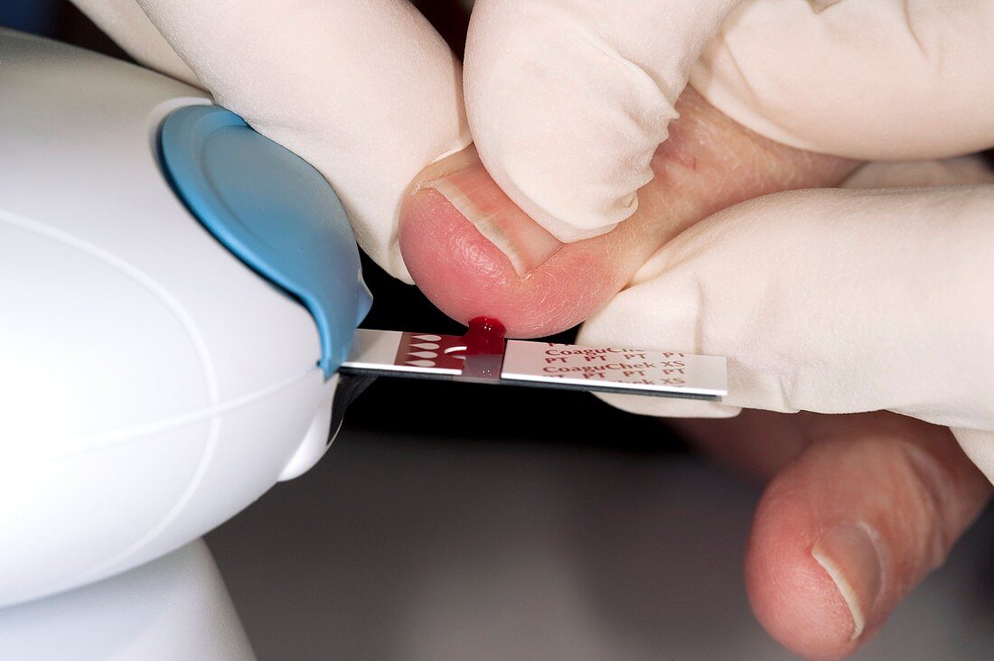 INR test for blood clotting