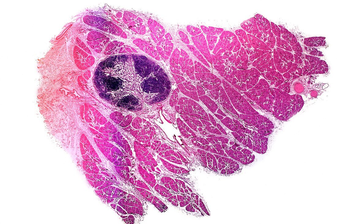 Parotid salivary gland,light micrograph