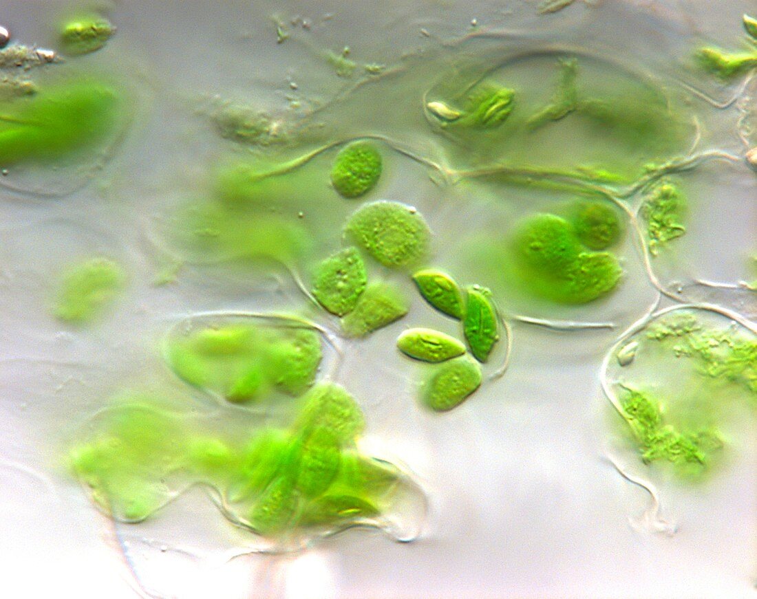Chloroplasts,light micrograph