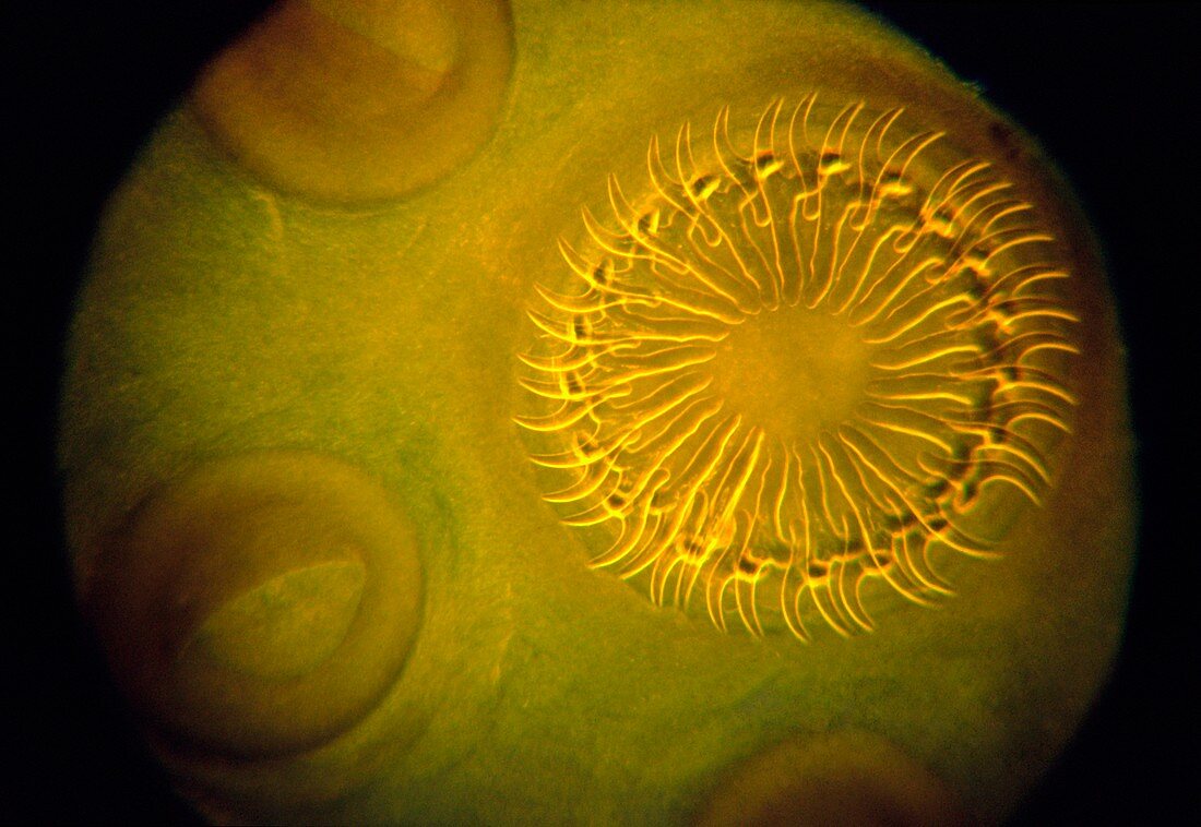 Pork tapeworm scolex,light micrograph