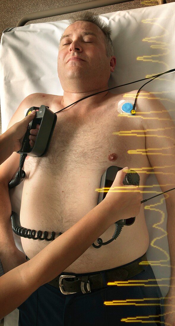 Resuscitation of heart attack patient