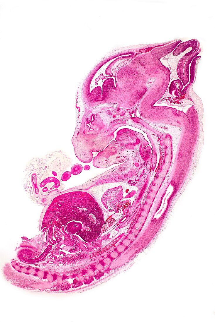 Rabbit embryo,light micrograph