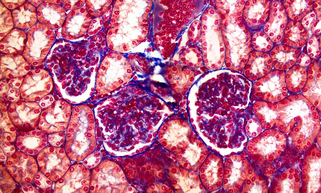 Kidney,light micrograph