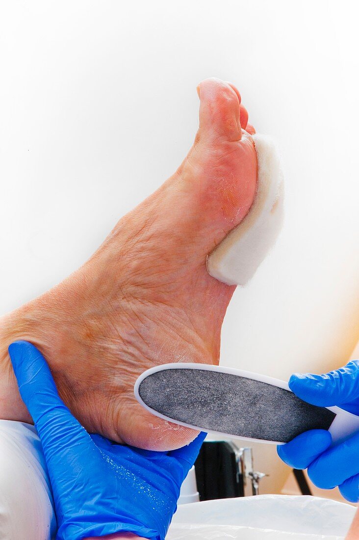 Scraping hard skin on a foot
