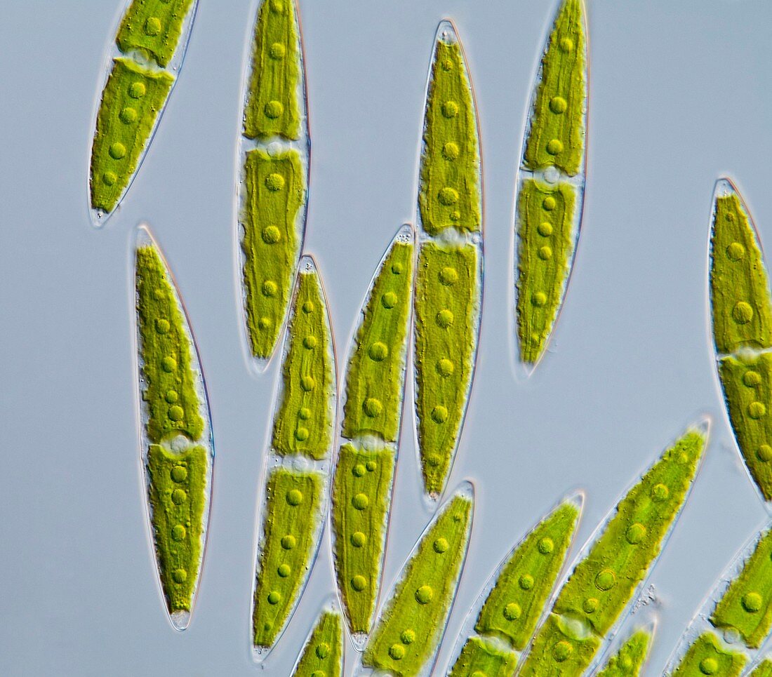 Green algae,light micrograph