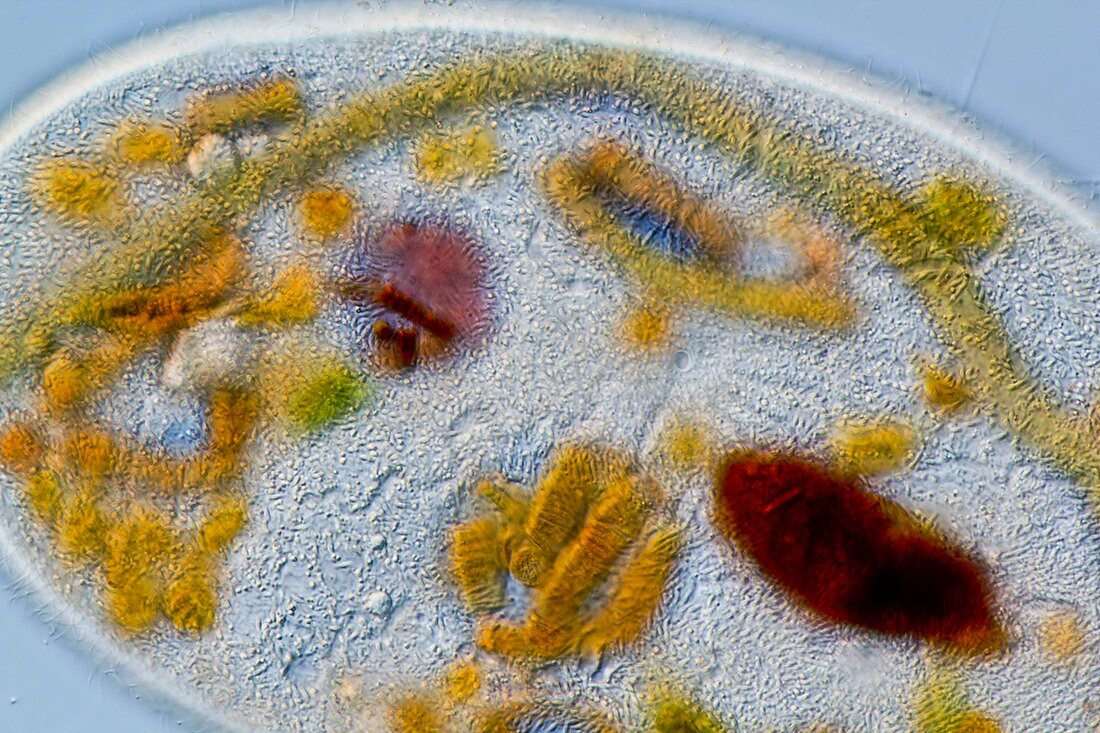 Frontonia protist,light micrograph