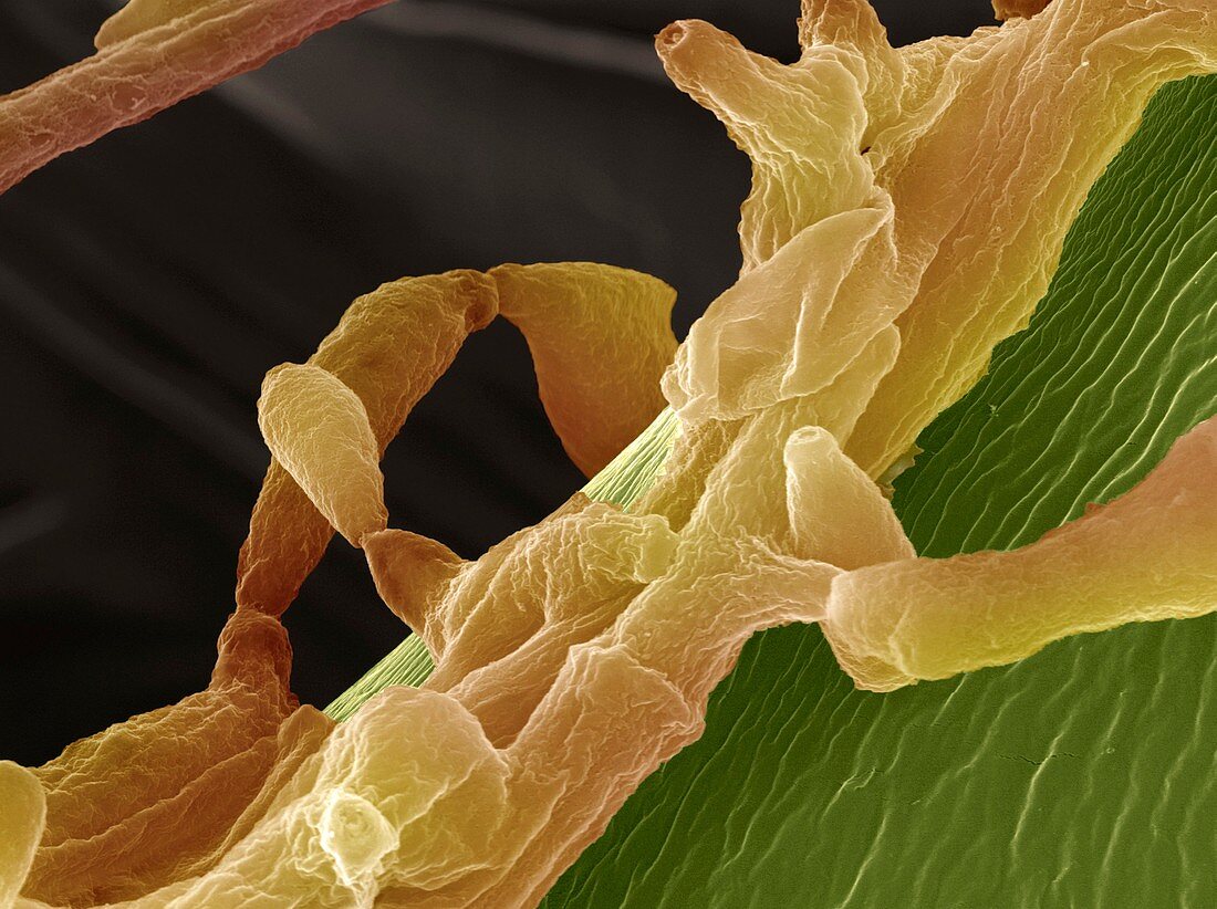 Apple tree fungus,SEM